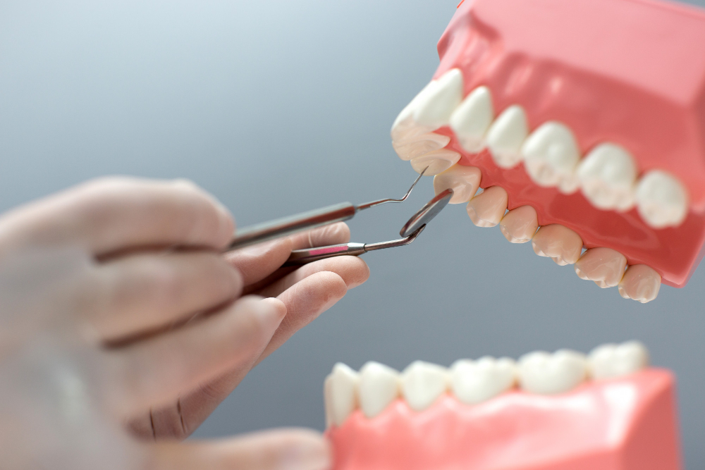 Sinais de Alerta: Quando Buscar Reabilitação Oral 1 dentes protese